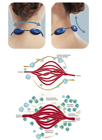 EMS Portable Lymphatic Relief Neck Massager