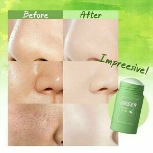 Last Day Special Sale 70% OFF-Non-Porous Deep Cleansing Mask Pen