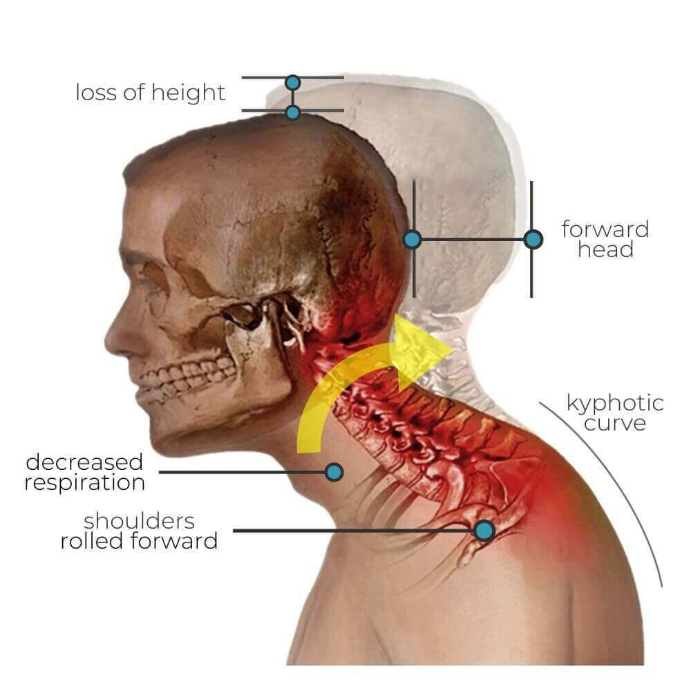 NeckFlexi™ - Get Relief From Neck Pain With This Tool