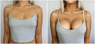 Lymphvity Detoxification and Shaping & Powerful Lifting Bra