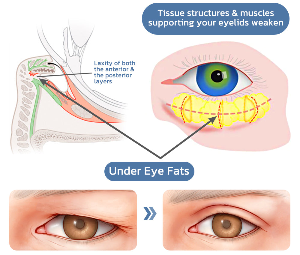 OPENEYES Awaken Peptide Lifting Eye Gel