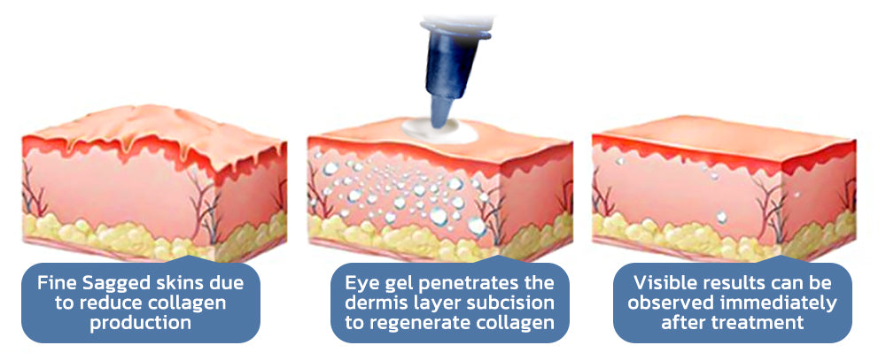 OPENEYES Awaken Peptide Lifting Eye Gel